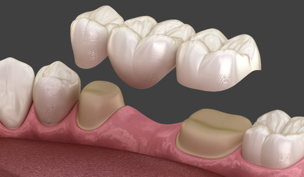 Tratamiento Temporomandibular en San Juan del Rio