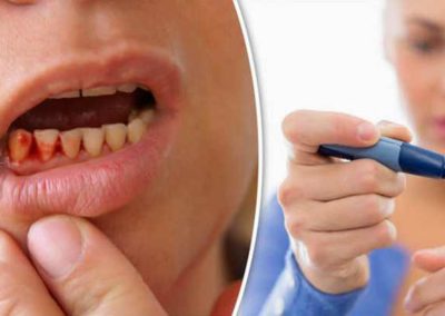 Como cuidar tus dientes si sufres de diabetes