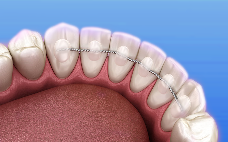 Como Cepillarse los Dientes